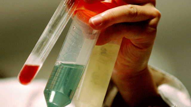 Modern tıbbın olmazsa olmazı nano teknoloji: Hayat kurtarmak için risk almak gerekiyor