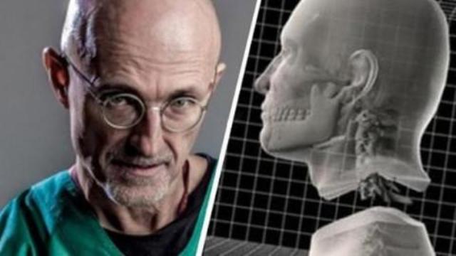 Kafa nakli yapmak isteyen profesöre Çin’den ret