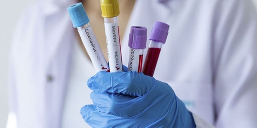 Bilim Kurulu üyesi Prof. Dr. Kara: HIV ve sıtma ilaçları virüsü zayıflatıyor