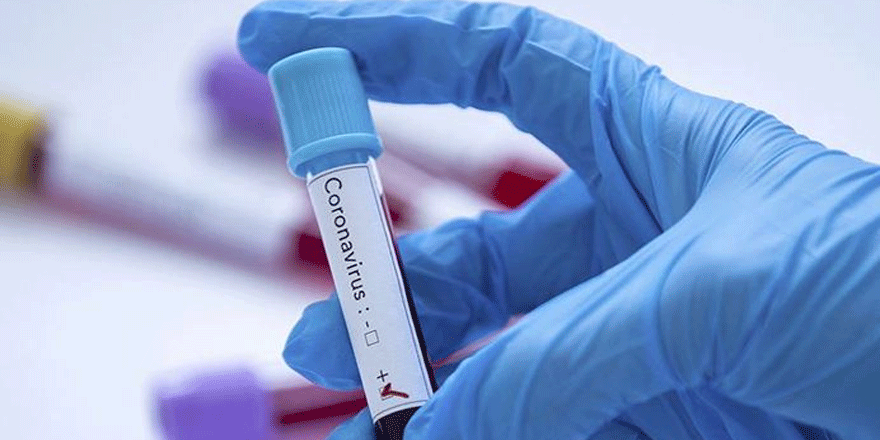 Türkiye'de coronavirüsten can kaybı 21'e yükseldi