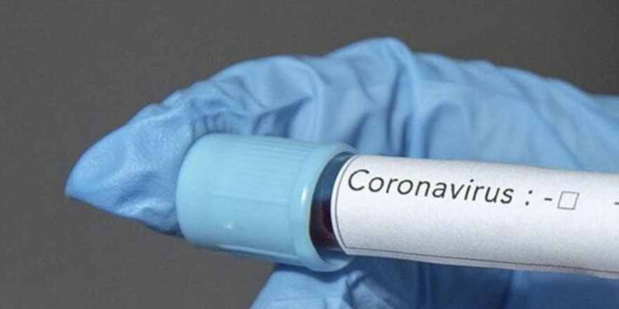 Dünya genelinde yeni tip koronavirüs vaka sayısı 11 milyonu aştı