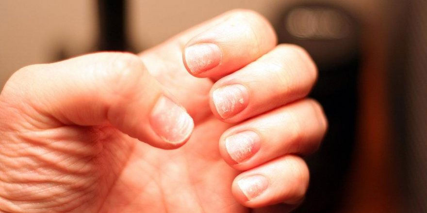 Tırnak kırılması ve soyulması nasıl önlenir?