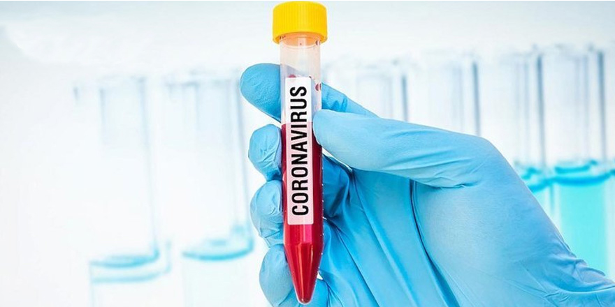 Test sonucu negatif çıktı