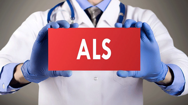 ALS hastalığı nedir? Tüm vücudu etkileyen ALS hastalığının belirtileri ve merak edilenler…