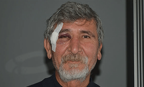 Poliste çifte standart!