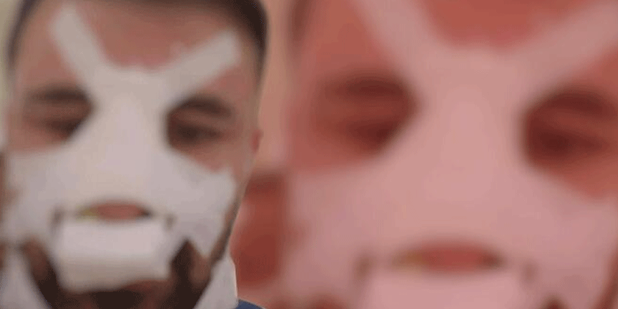 Sağlıkçının burnunu kıran zanlıdan şok sözler