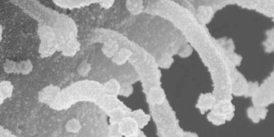 Koronavirüs hücresinin yeni fotoğrafı ortaya çıktı