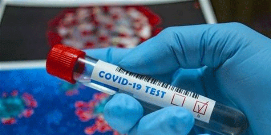 Son dakika: Rusya'da korkutan koronavirüs rekoru!