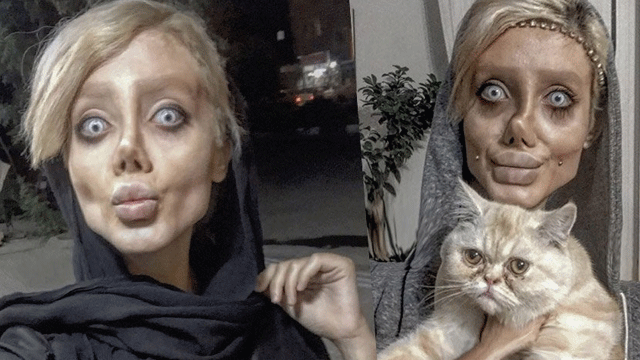 Estetik yaptırma isteğinin altında ne yatıyor?