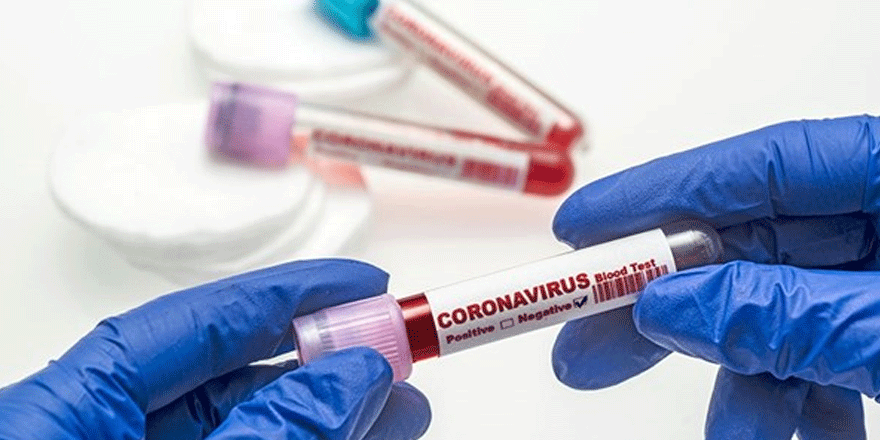 Akdoğan’da berberin testi pozitif çıktı