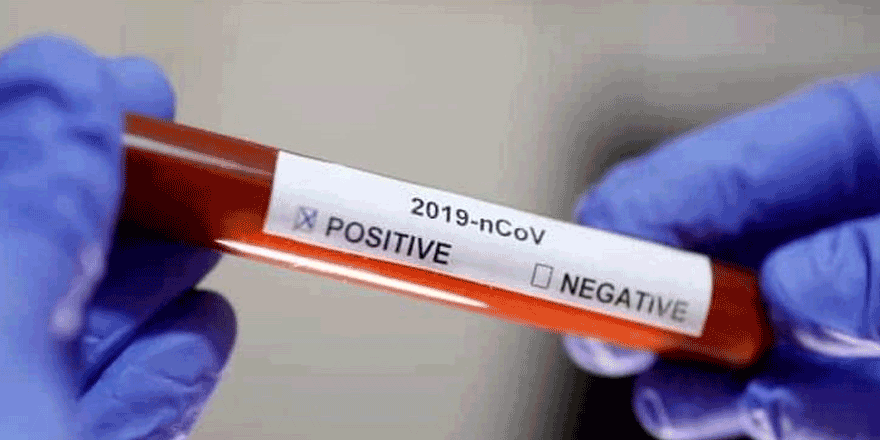 Mustafa Yüncü Lefkonuklu LTD'de pozitif vaka