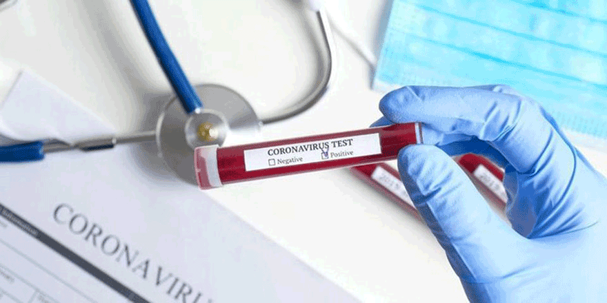 Başsavcılık'ta 1 temaslı vaka