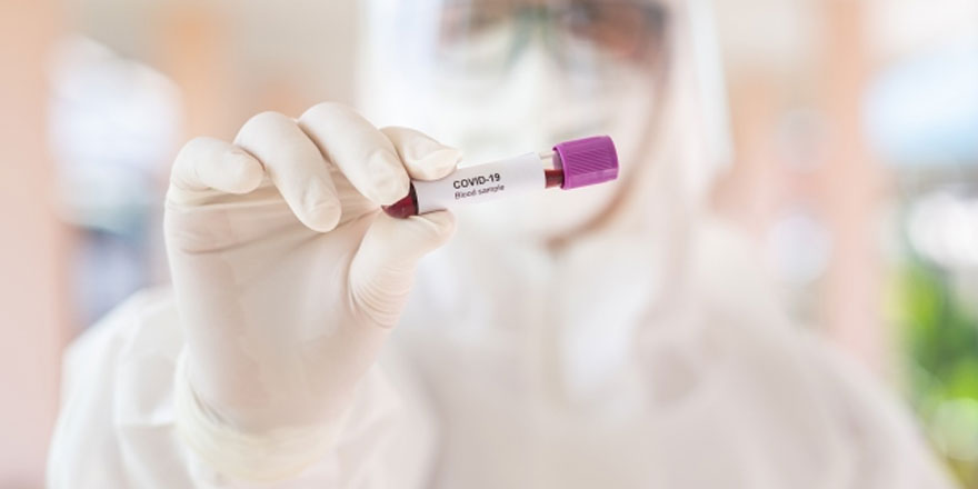 Sanayi Dairesi’nde 2 pozitif vaka