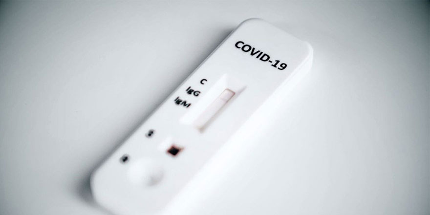 Tabipler: ''Onaylı olmayan hızlı testler kullanılıyor''