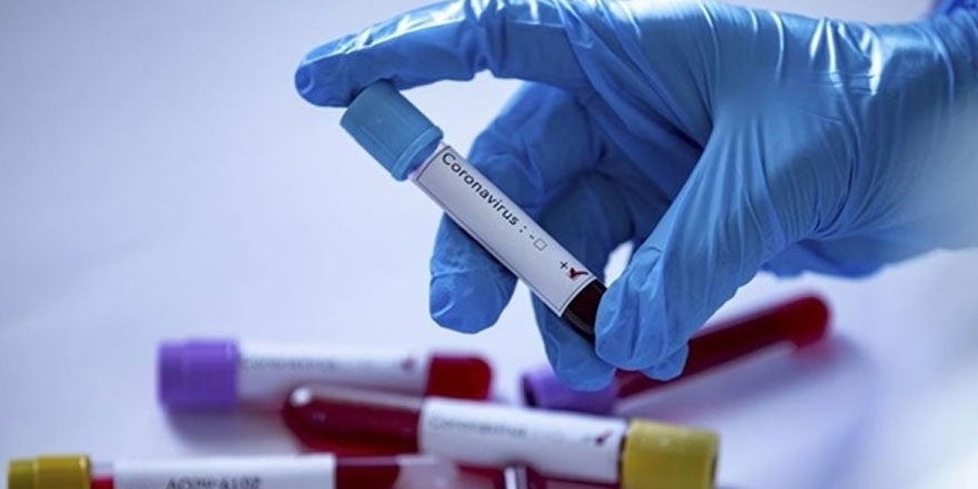 Dünya genelinde kovid-19 vaka sayısı 200 milyonu geçti