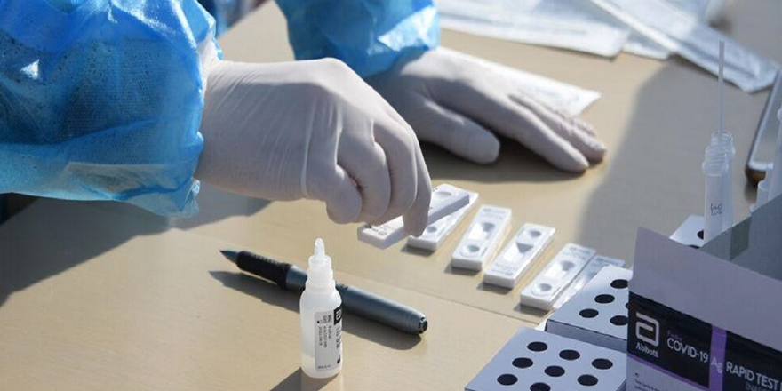 Türkiye’den 800 bin adet PCR ve 600 bin adet Antijen test kiti satın alınıyor