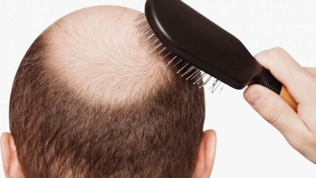 Saç çıkaran tarif!