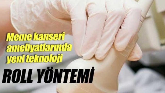 Meme kanseri ameliyatlarında yeni bir teknoloji: Roll yönetimi