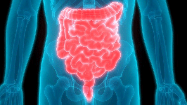 Crohn hastalığı nedir? Belirtileri nelerdir?