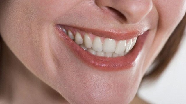 Evde diş plağı temizleme yolları