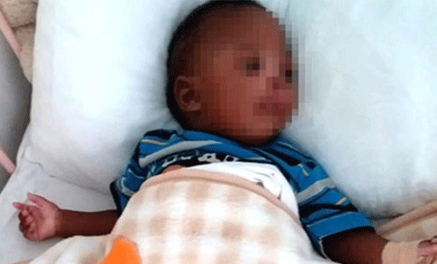 “Mucize bebek” Judy yaşamını kaybetti