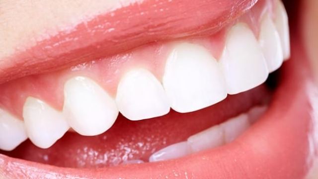 "Üst dişlerdeki enfeksiyonlar sinüzite neden olabilir"