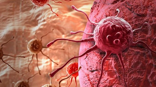 Türkiye’de her gün 450 kişiye kanser teşhisi konuluyor!