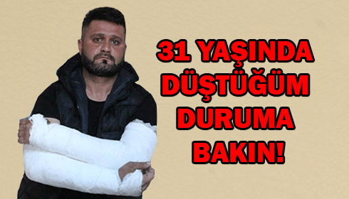 Karakolda kollarını kırdılar!