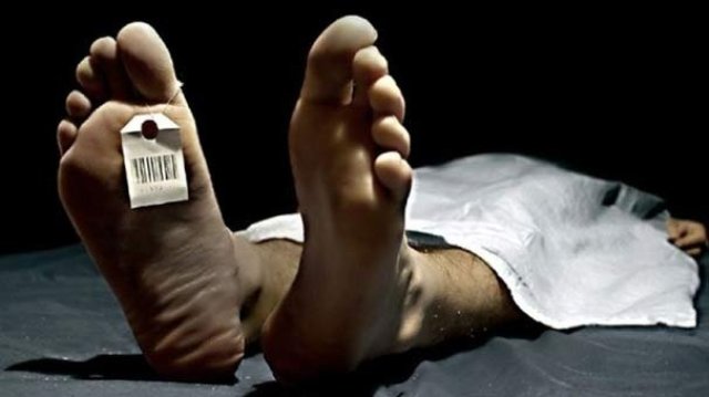 Öldükten 3.5 saat sonra dirilen hasta 10 gün sonra yaşamını yitirdi