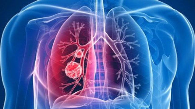 Tedavisi zor nadir hastalıklar masaya yatırıldı