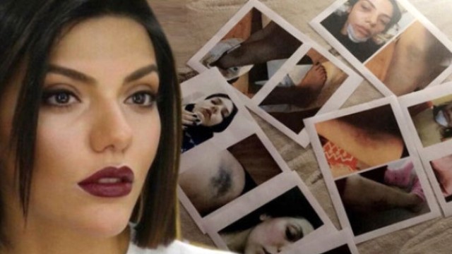 Sunucu Sevgilisine Şiddet Uygulayan Oyuncu Tolga Pancaroğlu'nun 5 Yıl Hapsi İstendi