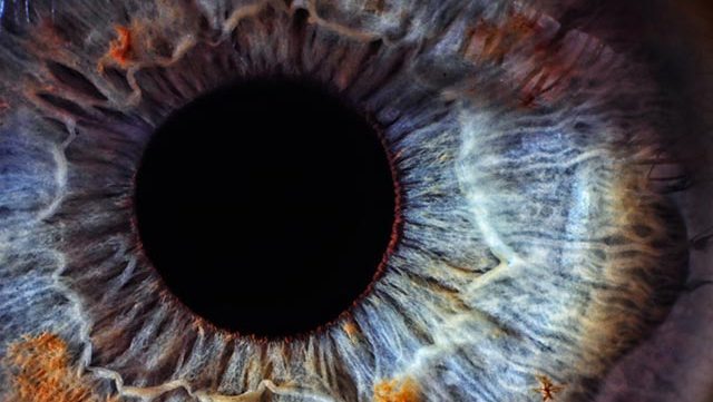 Sarı nokta hastalığı olanlar nasıl beslenmeli?