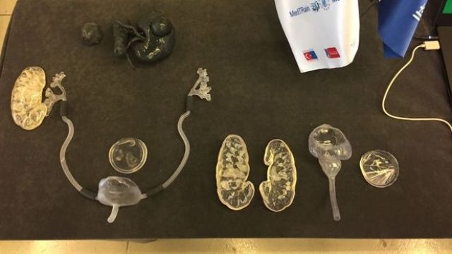 Türk bilim insanları cerrahide 3D teknolojisine imza attı