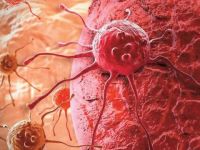 Kanserli hastanın yaşam süresi uzadı