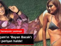 Yeşilçam'ın 'Bayan Bacak'ı Serpil Örümcer, Perişan Halde Yaşıyor
