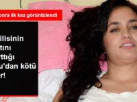 Sevgilisi Tarafından Vurulan Mutlu Kaya'nın Tedavisi Yarım Kaldı