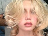 Dudaklarına Dolgu Yaptıran Aleyna Tilki'nin Son Görüntüsü Şaşırttı