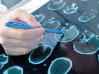 Türkiye’de 10 kişiden 1’i ‘epilepsi bulaşıcı’ dedi