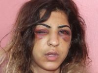 Adana'da bir kişi hem kuma getirdiği sevgilisini, hem eşini darp etti