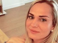 Survivor Nagihan Karadere botoks mu yaptırdı? O iddialara yanıt verdi