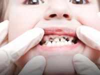 Gripten Sonra En Çok Görülen Çocukluk Çağı Hastalığı!