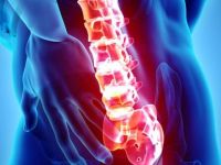 Omurilik felci en çok kazalar sonrası meydana geliyor