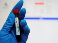 Babalık testi yaptıranların sayısı 3 katına çıktı