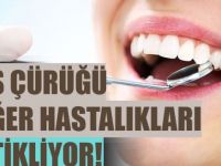 Diş çürüğü diğer hastalıkları tetikliyor