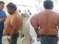 Doktorlar 4 yıldır gizemini çözemiyor! Denize daldı vücudu şişti