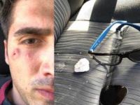 Yoldan seken taş gözüne isabet etti yaralandı