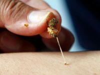 Bağışıklık sistemini arı zehri ile güçlendiriyorlar