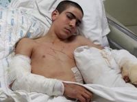 İzmir'de bir çocuğa Pitbull saldırdı