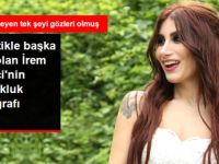 Estetikle Başka Biri Olan İrem Derici, Çocukluk Fotoğrafını Paylaştı