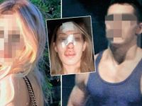 Mahkeme burun kıran eski sevgiliyi serbest bıraktı! Savcı ise...